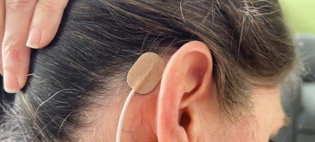 The device stimulates nerves to ease opioid-withdrawal symptoms such as stomach aches, back aches, sweats and the inability to keep food down.